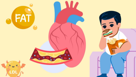 4 thói quen vô tình khiến cholesterol tăng cao