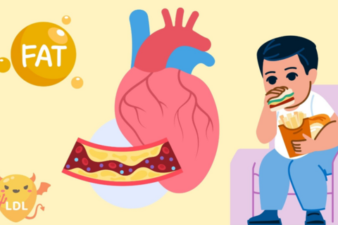 4 thói quen vô tình khiến cholesterol tăng cao