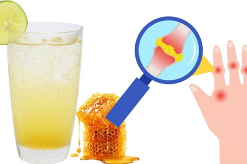 Người có axit uric cao nên cẩn trọng khi uống nước mật ong buổi sáng