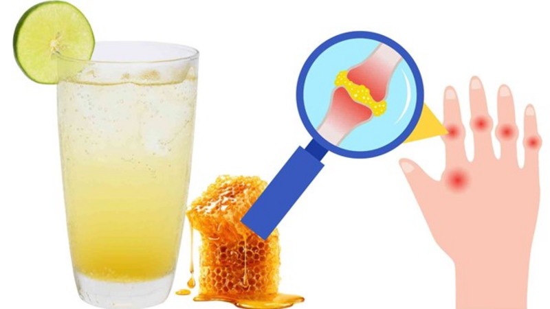Người có axit uric cao nên cẩn trọng khi uống nước mật ong buổi sáng