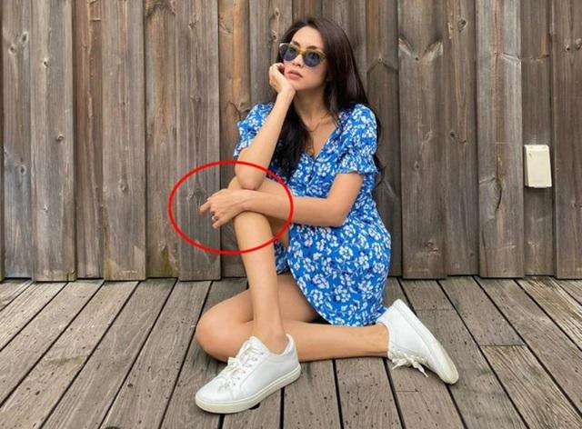 Tăng Thanh Hà lần đầu chia sẻ về căn bệnh đeo đẳng suốt 3 năm khiến cô bị sụt cân, tăng nguy cơ ung thư cao khiến cô vô cùng lo lắng - Ảnh 2.