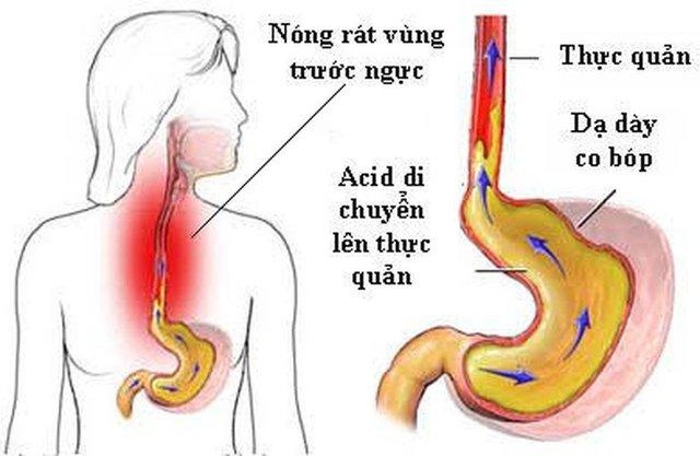 Tăng Thanh Hà lần đầu chia sẻ về căn bệnh đeo đẳng suốt 3 năm khiến cô bị sụt cân, tăng nguy cơ ung thư cao khiến cô vô cùng lo lắng - Ảnh 4.