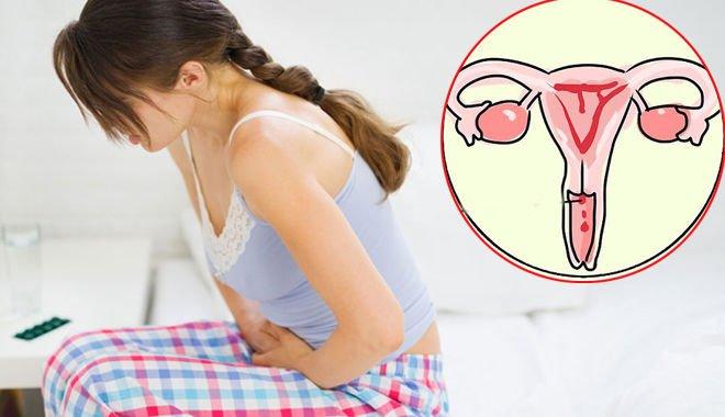 Viêm cổ tử cung là là tình trạng viêm nhiễm ở bộ phận sinh dục nữ thường gặp nhất trong độ tuổi sinh sản. Ảnh minh hoạ Viêm cổ tử cung là là tình trạng viêm nhiễm ở bộ phận sinh dục nữ thường gặp nhất trong độ tuổi sinh sản. Ảnh minh hoạ