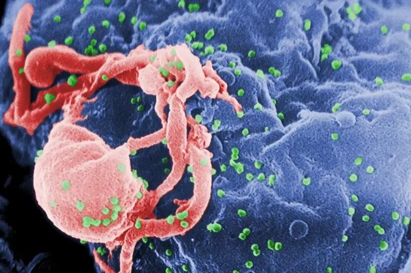 Người thứ ba được chữa khỏi HIV - Ảnh 1. Người thứ ba được chữa khỏi HIV - Ảnh 1.