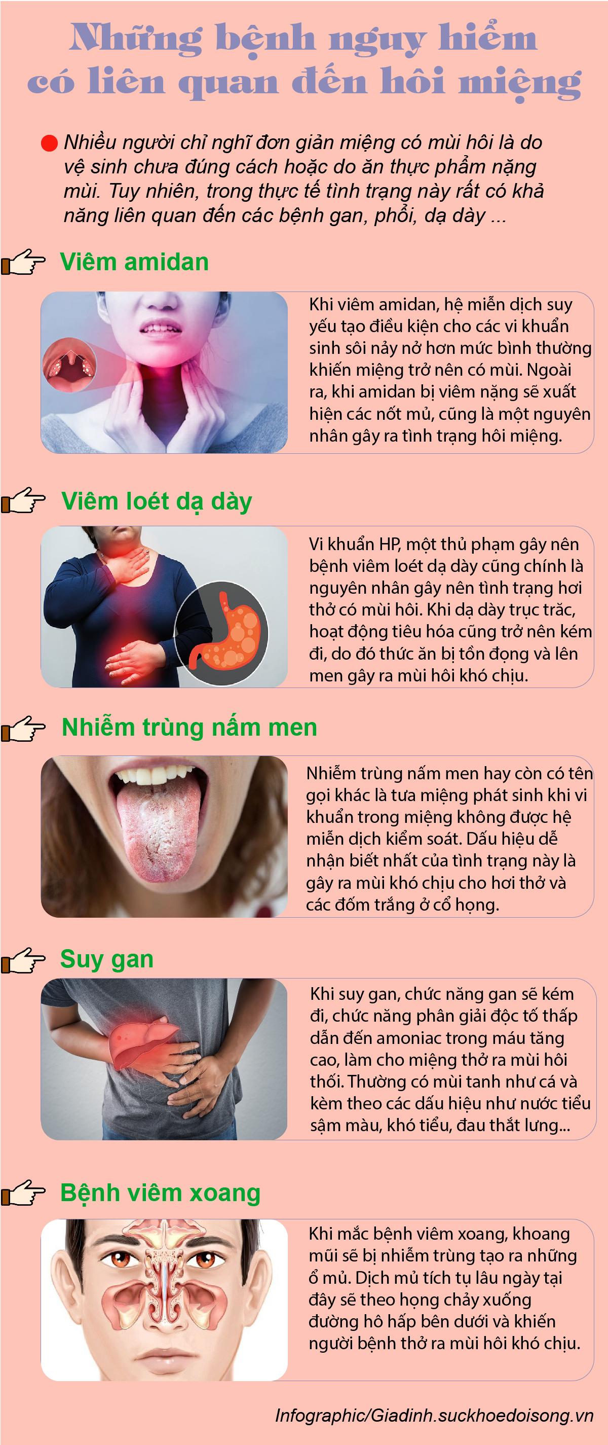 Khi miệng có mùi hôi, đừng chủ quan vì đây rất có thể là dấu hiệu của các căn bệnh nguy hiểm - Ảnh 1.