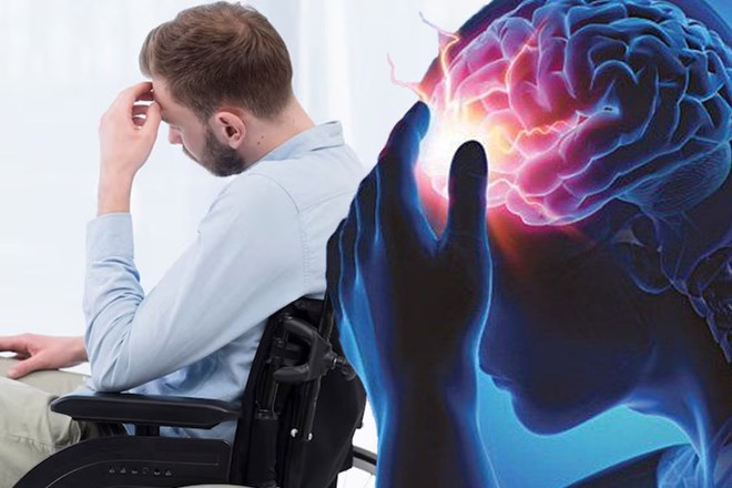 Bệnh đa xơ cứng có thể gây ra các vấn đề về thần kinh
