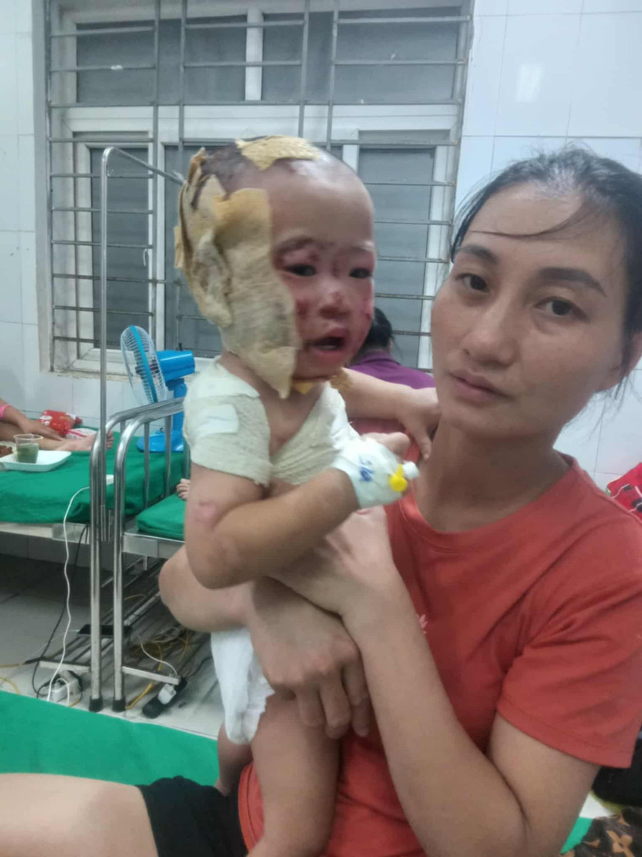 Gần 2 tuần điều trị nhưng tình trạng của Như Quỳnh chưa tiến triển được nhiều. anh4.jpg