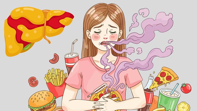 Dấu hiệu sau bữa ăn cảnh báo gan nhiễm mỡ