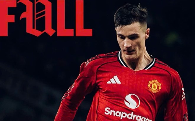 Man United bị loại ngay vòng 3 FA Cup