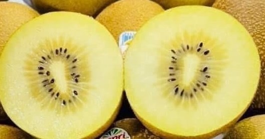 Tác dụng hạ huyết áp tự nhiên của quả kiwi