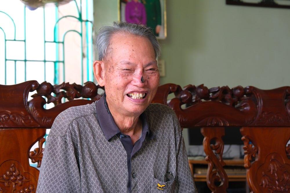 Ông Hoàng Dũng và vết mổ lần thứ 2 từ di chứng bệnh ung thư nhưng vẫn lạc quan. Ảnh: Lục Tùng.